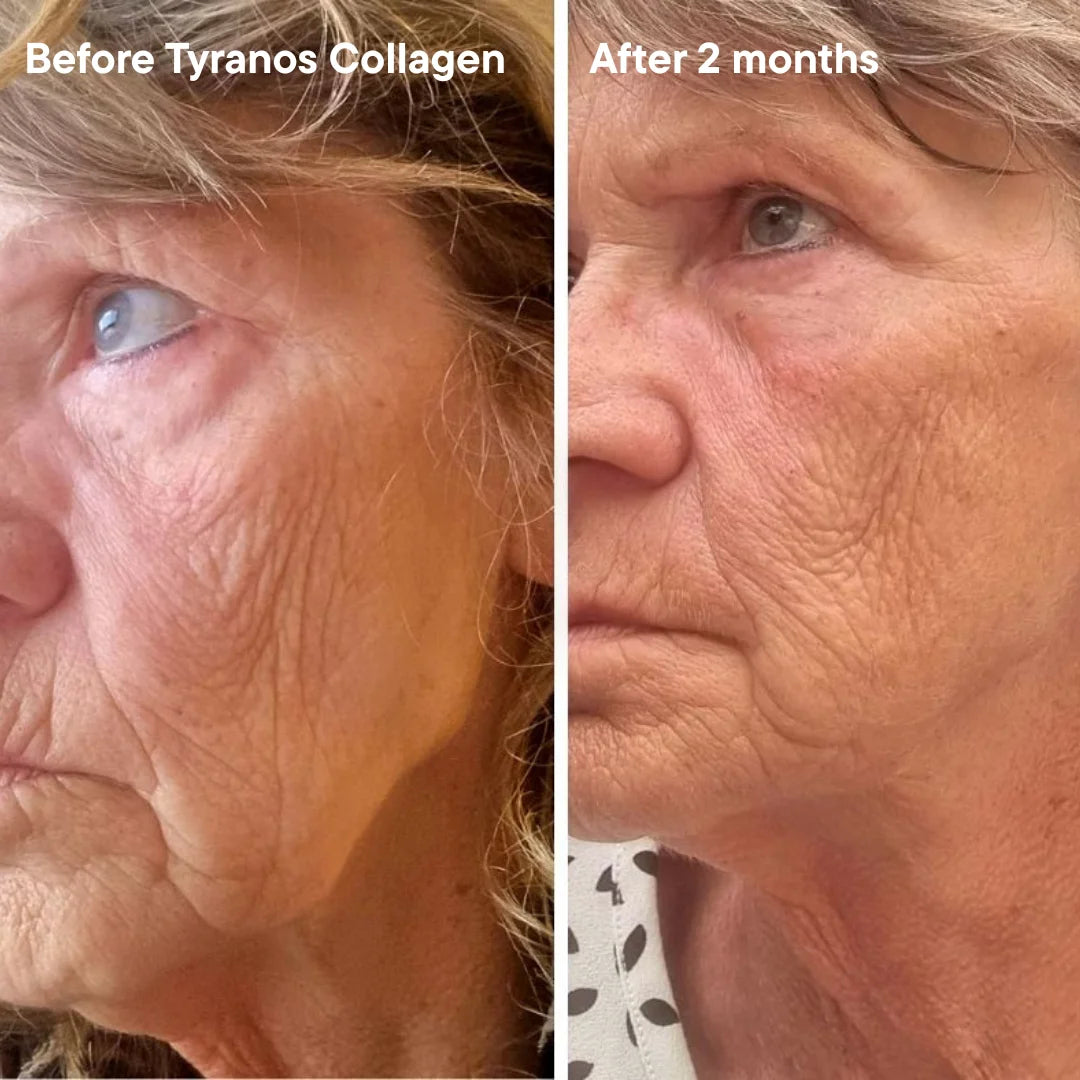 Tyranos - Bold & Glow pakket: Van binnen sterk, van buiten zichtbaar.